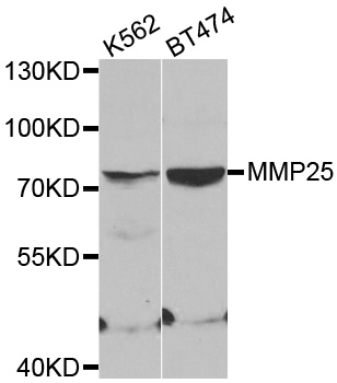 MMP25 / Leukolysin Antibody - Western blot analysis of extracts of various cell lines.