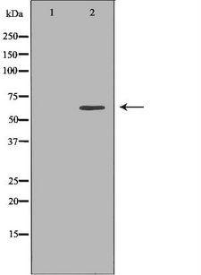 MMP25 / Leukolysin Antibody - Western blot analysis of extracts of 823 cell lysate using MMP25 antibody. The lane on the left is treated with the antigen-specific peptide.