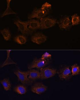 MMP25 / Leukolysin Antibody - Immunofluorescence analysis of C6 cells using MMP25 Polyclonal Antibody at dilution of 1:100.Blue: DAPI for nuclear staining.