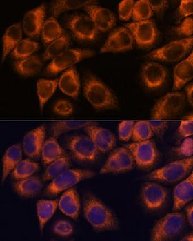 MMP25 / Leukolysin Antibody - Immunofluorescence analysis of HeLa cells using MMP25 Polyclonal Antibody at dilution of 1:100.Blue: DAPI for nuclear staining.