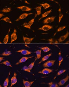 MMP25 / Leukolysin Antibody - Immunofluorescence analysis of L929 cells using MMP25 Polyclonal Antibody at dilution of 1:100.Blue: DAPI for nuclear staining.