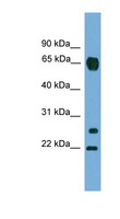 MMP26 Antibody - MMP26 antibody Western blot of A549 cell lysate. This image was taken for the unconjugated form of this product. Other forms have not been tested.