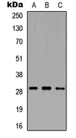 MMP26 Antibody - Western blot analysis of MMP26 expression in HEK293T (A); Raw264.7 (B); H9C2 (C) whole cell lysates.