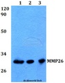 MMP26 Antibody - Western blot of MMP26 antibody at 1:500 dilution. Lane 1: HEK293T whole cell lysate. Lane 2: Raw264.7 whole cell lysate. Lane 3: H9C2 whole cell lysate.