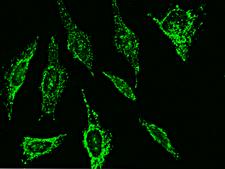MMP26 Antibody - Immunofluorescence staining of MMP26 in Hela cells. Cells were fixed with 4% PFA, permeabilzed with 0.3% Triton X-100 in PBS, blocked with 10% serum, and incubated with rabbit anti-Human MMP26 polyclonal antibody (dilution ratio: 1:1000) at 4°C overnight. Then cells were stained with the Alexa Fluor 488-conjugated Goat Anti-rabbit IgG secondary antibody (green)Positive staining was localized to cytoplasm.