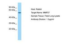MMP27 Antibody -  This image was taken for the unconjugated form of this product. Other forms have not been tested.