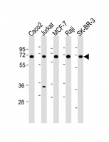 MMP27 Antibody - All lanes: Anti-MMP27 Antibody (Center) at 1:2000 dilution. Lane 1: Caco2 whole cell lysates. Lane 2: Jurkat whole cell lysates. Lane 3: MCF-7 whole cell lysates. Lane 4: Raji whole cell lysates. Lane 5: SK-BR-3 whole cell lysates Lysates/proteins at 20 ug per lane. Secondary Goat Anti-Rabbit IgG, (H+L), Peroxidase conjugated at 1:10000 dilution. Predicted band size: 59 kDa. . Blocking/Dilution buffer: 5% NFDM/TBST.