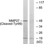 MMP27 Antibody - Western blot of extracts from COS7 cells, treated with etoposide 25 uM 1h, using MMP27 (Cleaved-Tyr99) Antibody. The lane on the right is treated with the synthesized peptide.