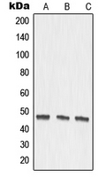 MMP27 Antibody - Western blot analysis of MMP27 expression in DLD (A); mouse kidney (B); rat kidney (C) whole cell lysates.