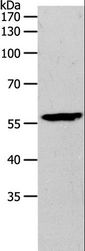 MMP27 Antibody - Western blot analysis of Mouse brain tissue, using MMP27 Polyclonal Antibody at dilution of 1:500.