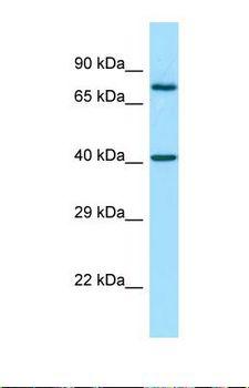 MMP28 Antibody - Western blot of Human THP-1. MMP28 antibody dilution 1.0 ug/ml.  This image was taken for the unconjugated form of this product. Other forms have not been tested.
