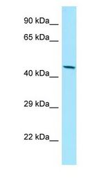 MMP28 Antibody - MMP28 / MMP-28 antibody Western Blot of HepG2.  This image was taken for the unconjugated form of this product. Other forms have not been tested.