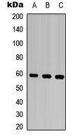 MMP28 Antibody - Western blot analysis of MMP28 expression in HEK293T (A); Raw264.7 (B); PC12 (C) whole cell lysates.