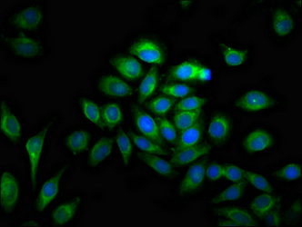 MMP28 Antibody - Immunofluorescence staining of A549 cells at a dilution of 1:133, counter-stained with DAPI. The cells were fixed in 4% formaldehyde, permeabilized using 0.2% Triton X-100 and blocked in 10% normal Goat Serum. The cells were then incubated with the antibody overnight at 4°C.The secondary antibody was Alexa Fluor 488-congugated AffiniPure Goat Anti-Rabbit IgG (H+L) .