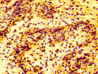 MMP28 Antibody - Immunohistochemistry image at a dilution of 1:100 and staining in paraffin-embedded human lung tissue performed on a Leica BondTM system. After dewaxing and hydration, antigen retrieval was mediated by high pressure in a citrate buffer (pH 6.0) . Section was blocked with 10% normal goat serum 30min at RT. Then primary antibody (1% BSA) was incubated at 4 °C overnight. The primary is detected by a biotinylated secondary antibody and visualized using an HRP conjugated SP system.