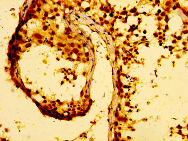MMP28 Antibody - Immunohistochemistry image at a dilution of 1:100 and staining in paraffin-embedded human testis tissue performed on a Leica BondTM system. After dewaxing and hydration, antigen retrieval was mediated by high pressure in a citrate buffer (pH 6.0) . Section was blocked with 10% normal goat serum 30min at RT. Then primary antibody (1% BSA) was incubated at 4 °C overnight. The primary is detected by a biotinylated secondary antibody and visualized using an HRP conjugated SP system.
