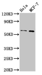 MMP28 Antibody - Positive Western Blot detected in Hela whole cell lysate, MCF-7 whole cell lysate. All lanes: MMP28 antibody at 3.2 µg/ml Secondary Goat polyclonal to rabbit IgG at 1/50000 dilution. Predicted band size: 59, 15 KDa. Observed band size: 59 KDa