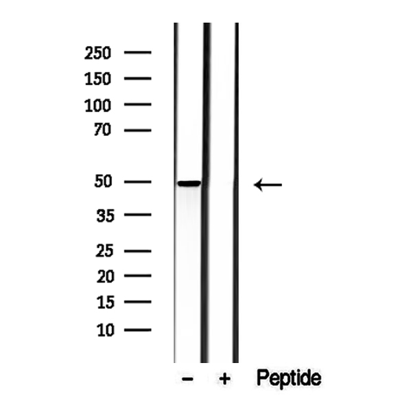 MMP28 Antibody - Western blot analysis of extracts of mouse heart tissue using MMP28 antibody.