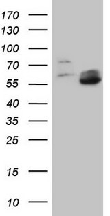 MMP3 Antibody - HEK293T cells were transfected with the pCMV6-ENTRY control. (Left lane) or pCMV6-ENTRY MMP3. (Right lane) cDNA for 48 hrs and lysed. Equivalent amounts of cell lysates. (5 ug per lane) were separated by SDS-PAGE and immunoblotted with anti-MMP3.