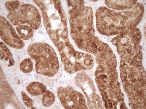 MMP3 Antibody - Immunohistochemical staining of paraffin-embedded Human Kidney tissue within the normal limits using anti-MMP3 mouse monoclonal antibody. (Heat-induced epitope retrieval by 1 mM EDTA in 10mM Tris, pH8.5, 120C for 3min,