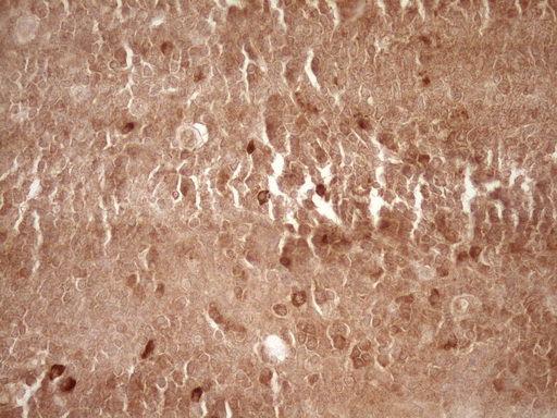 MMP3 Antibody - IHC of paraffin-embedded Human tonsil using anti-MMP3 mouse monoclonal antibody. (Heat-induced epitope retrieval by 1 mM EDTA in 10mM Tris, pH8.5, 120°C for 3min).