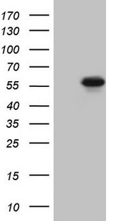 MMP3 Antibody - HEK293T cells were transfected with the pCMV6-ENTRY control (Left lane) or pCMV6-ENTRY MMP3 (Right lane) cDNA for 48 hrs and lysed. Equivalent amounts of cell lysates (5 ug per lane) were separated by SDS-PAGE and immunoblotted with anti-MMP3.