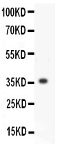 MMP3 Antibody - MMP3 antibody Western blot. All lanes: Anti MMP3 at 0.5 ug/ml. WB: Recombinant Human MMP3 Protein 0.5ng. Predicted band size: 36 kD. Observed band size: 36 kD.