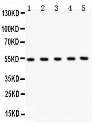 MMP3 Antibody - MMP3 antibody Western blot. All lanes: Anti MMP3 at 0.5 ug/ml. Lane 1: Human Placenta Tissue Lysate at 50 ug. Lane 2: U20S Whole Cell Lysate at 40 ug. Lane 3: HELA Whole Cell Lysate at 40 ug. Lane 4: PANC Whole Cell Lysate at 40 ug. Lane 5: COLO320 Whole Cell Lysate at 40 ug. Predicted band size: 54 kD. Observed band size: 54 kD.