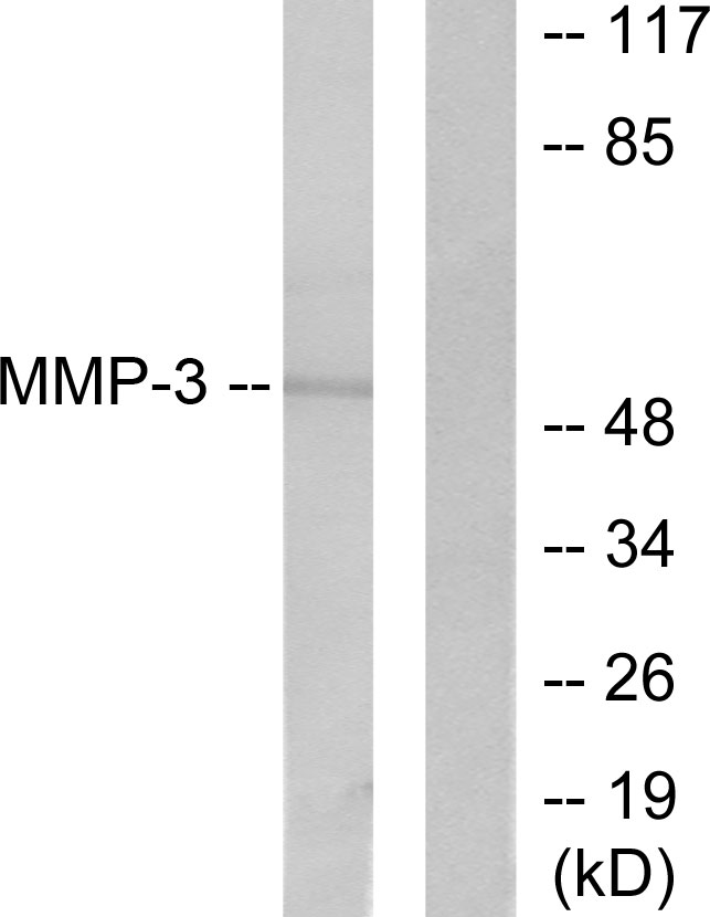 MMP3 Antibody - Western blot analysis of lysates from 293 cells, using MMP-3 Antibody. The lane on the right is blocked with the synthesized peptide.