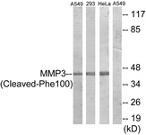 MMP3 Antibody - Western blot of extracts from A549/293/HeLa cells, treated with etoposide 25 uM 24h, using MMP3 (Cleaved-Phe100) Antibody. The lane on the right is treated with the synthesized peptide.