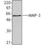 MMP3 Antibody - Western blot of recombinant human MMP-3 protein using anti-MMP-3, clone F36P1B4.