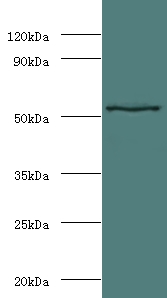 MMP3 Antibody - Western blot of Stromelysin-1 antibody at 2 ug/ml with mouse liver tissue Secondary Goat polyclonal to Rabbit lgG at 1:15000 dilution. Predicted band size: 54 KDa. Observed band size: 54 KDa.  This image was taken for the unconjugated form of this product. Other forms have not been tested.