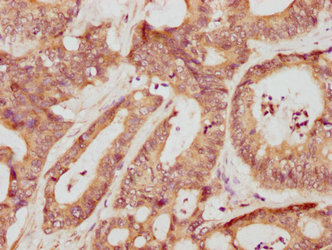 MMP3 Antibody - Immunohistochemistry of paraffin-embedded human placenta tissue using Mmp3 Antibody at dilution of 1:20