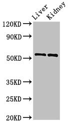 MMP3 Antibody - Western Blot Positive WB detected in: mouse liver tissue, Mouse kidney tissue All lanes: Mmp3 antibody at 2.8µg/ml Secondary Goat polyclonal to rabbit IgG at 1/50000 dilution Predicted band size: 54 kDa Observed band size: 54 kDa