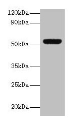 MMP3 Antibody - Western blot All lanes: Stromelysin-1 antibody at 2µg/ml + Mouse liver tissue Secondary Goat polyclonal to rabbit lgG at 1/15000 dilution Predicted band size: 54 kDa Observed band size: 54 kDa