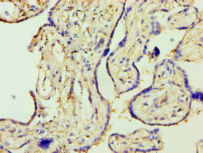 MMP3 Antibody - Immunohistochemistry of paraffin-embedded human placenta tissue using MMP3 Antibody at dilution of 1:100