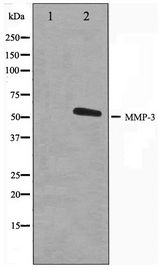 MMP3 Antibody - Western blot of 293 cell lysate using MMP3 Antibody