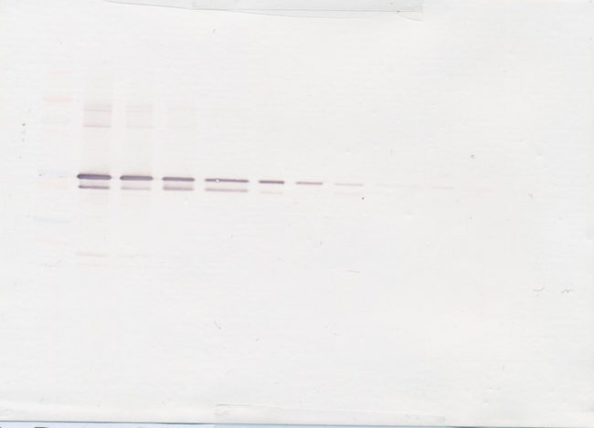 MMP3 Antibody - Anti-Human MMP-3 Western Blot Reduced