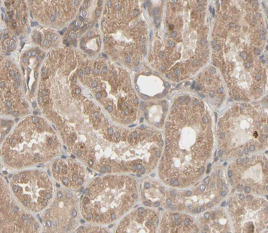 MMP3 Antibody - 1:100 staining human kidney tissue by IHC-P. The tissue was formaldehyde fixed and a heat mediated antigen retrieval step in citrate buffer was performed. The tissue was then blocked and incubated with the antibody for 1.5 hours at 22 °C. An HRP conjugated goat anti-rabbit antibody was used as the secondary.