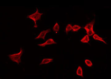 MMP3 Antibody - Staining 293 cells by IF/ICC. The samples were fixed with PFA and permeabilized in 0.1% Triton X-100, then blocked in 10% serum for 45 min at 25°C. The primary antibody was diluted at 1:200 and incubated with the sample for 1 hour at 37°C. An Alexa Fluor 594 conjugated goat anti-rabbit IgG (H+L) Ab, diluted at 1/600, was used as the secondary antibody.