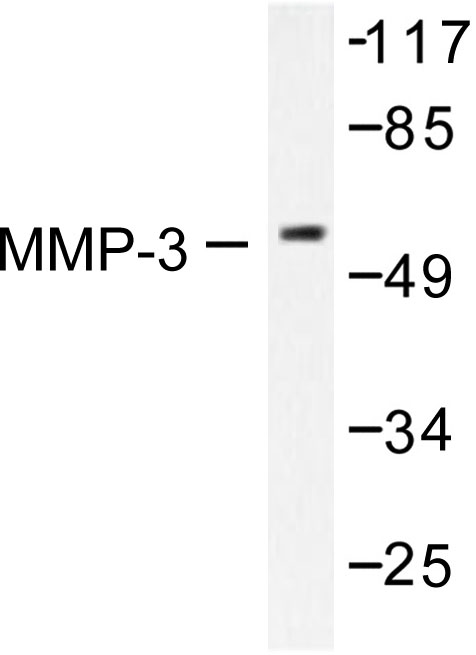 MMP3 Antibody - Western blot of MMP-3 (S453) pAb in extracts from 293 cells.