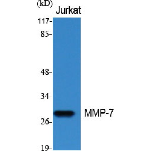 MMP7 / Matrilysin Antibody - Western blot of MMP-7 antibody