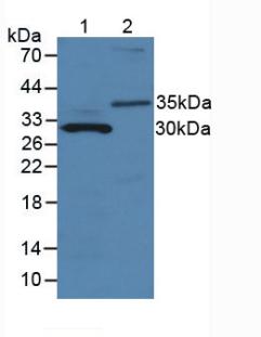 MMP7 / Matrilysin Antibody - Western Blot; Sample: Lane1: Mouse Pancreas Tissue; Lane2: Human Urine.