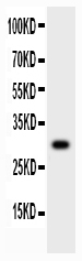 MMP7 / Matrilysin Antibody - Western blot - Anti-MMP-7 Antibody