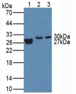 MMP7 / Matrilysin Antibody - Western Blot; Sample. Lane1: Human Urine; Lane2: Porcine Lung Tissue; Lane3: Mouse Placenta Tissue.
