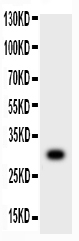 MMP7 / Matrilysin Antibody - Western blot - Anti-MMP-7 Antibody