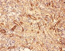MMP7 / Matrilysin Antibody - IHC-P: MMP7 antibody testing of mouse kidney tissue