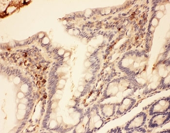 MMP7 / Matrilysin Antibody - IHC-P: MMP7 antibody testing of rat intestine tissue