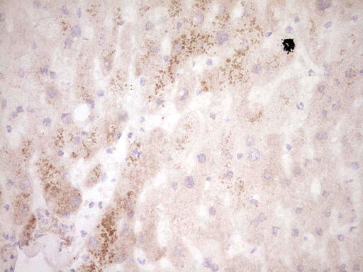 MMP7 / Matrilysin Antibody - Immunohistochemical staining of paraffin-embedded Human liver tissue within the normal limits using anti-MMP7 mouse monoclonal antibody. (Heat-induced epitope retrieval by 1 mM EDTA in 10mM Tris, pH8.5, 120C for 3min,