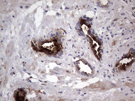 MMP7 / Matrilysin Antibody - Immunohistochemical staining of paraffin-embedded Human prostate tissue within the normal limits using anti-MMP7 mouse monoclonal antibody. (Heat-induced epitope retrieval by 1 mM EDTA in 10mM Tris, pH8.5, 120C for 3min,